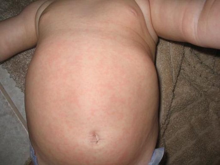 Vir: mommyhood101.com